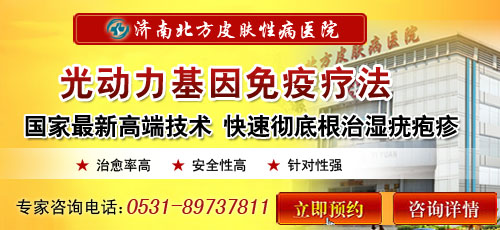 济南尖锐湿疣的早期症状图片,北方医院