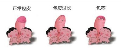 南昌哪个医院割包皮好