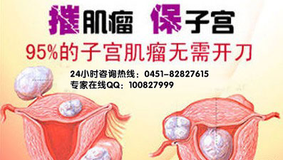 黑龙江治疗子宫肌瘤,哈尔滨哪家妇科医院比较