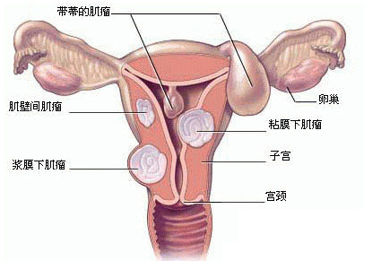 郑州看妇科到哪家医院好?