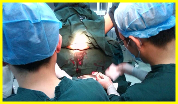 西安马应龙肛肠医院肛二科紧急抢救痔疮大出血